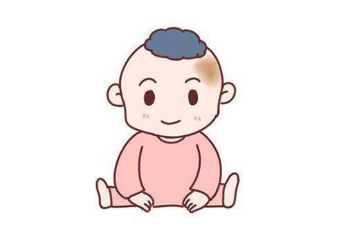 「胎记热点」哪些因素会造成咖啡斑患者色素沉着加重？