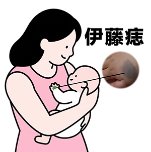 <strong>伊藤痣和太田痣有什么区别？南京治胎记哪家医院口碑好？</strong>