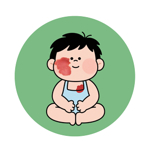 <strong>[南京祛胎记医院]鲜红斑痣可以预防吗？孕期要注意什么？</strong>