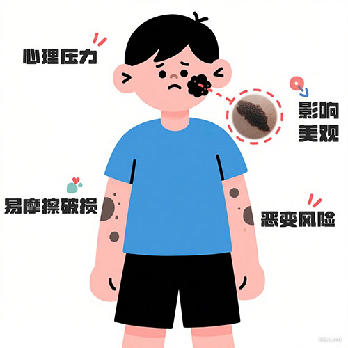 <strong>黑毛痣胎记对身体有影响吗？南京胎记医院哪里好？</strong>