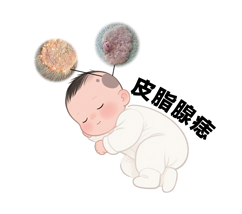 <strong>胎记健康・皮脂腺痣是良性还是恶性？哪些症状需警惕？</strong>