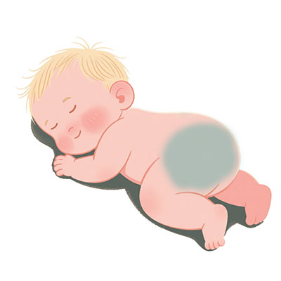 <strong>小孩子胎记长大会自己消失吗？江苏看胎记比较好的医院有几家？</strong>