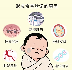 <strong>皮肤手册：宝宝胎记是什么原因造成的？能预防吗？</strong>