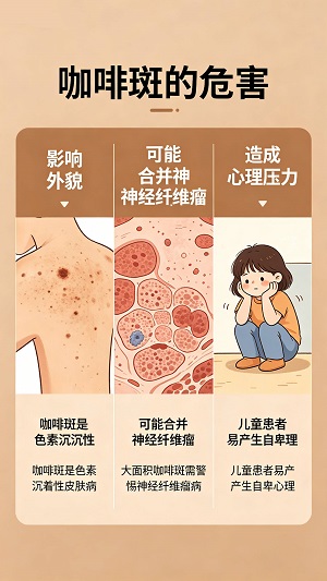 南京治疗咖啡斑的医院排名第几？咖啡斑的成因与科学治疗